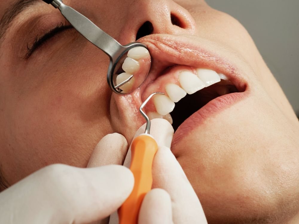 Походы к зубному врачу избавят от деменции