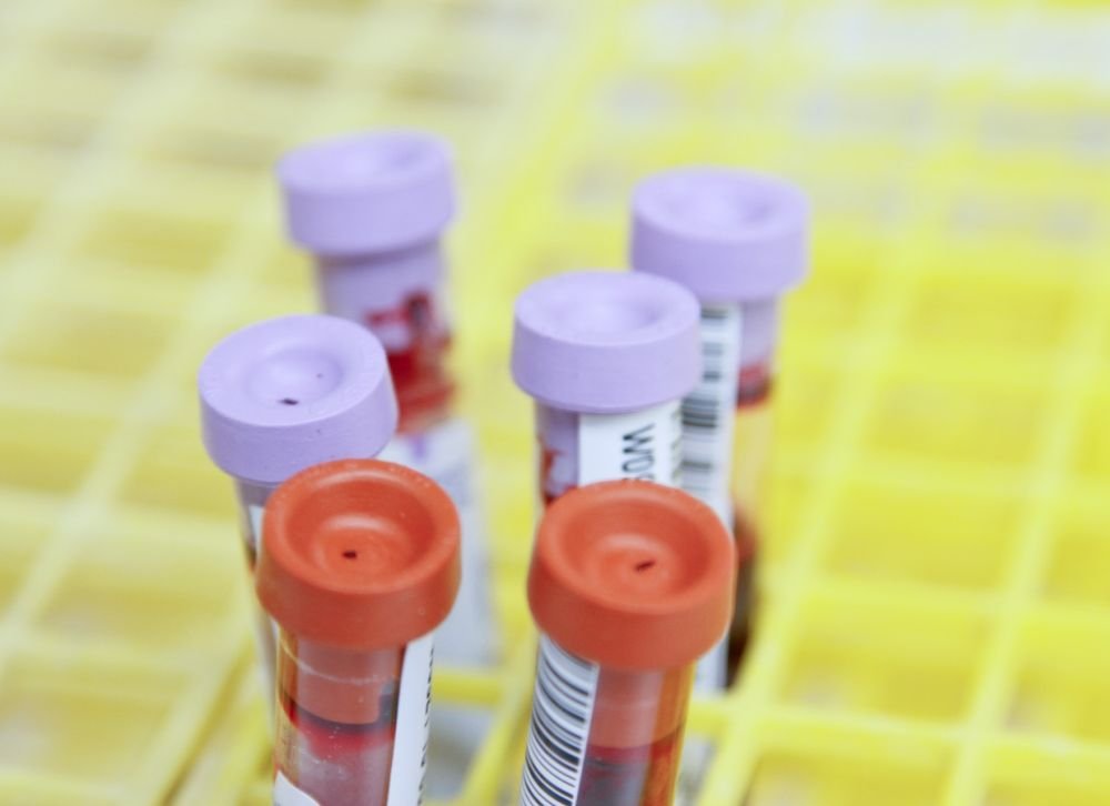 Анализ крови выявит 50 разновидностей рака