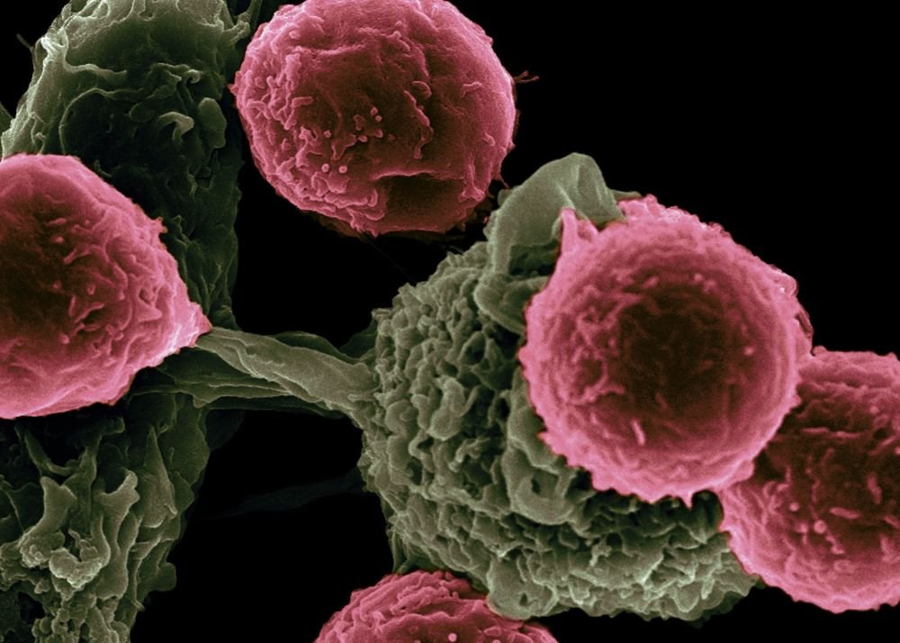 Установлено, как рак захватывает клетки