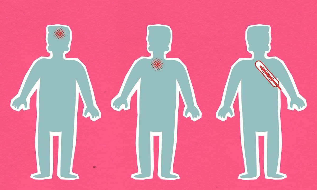 Фарингит - ключевой симптом ковида на фоне тревожного роста числа случаев