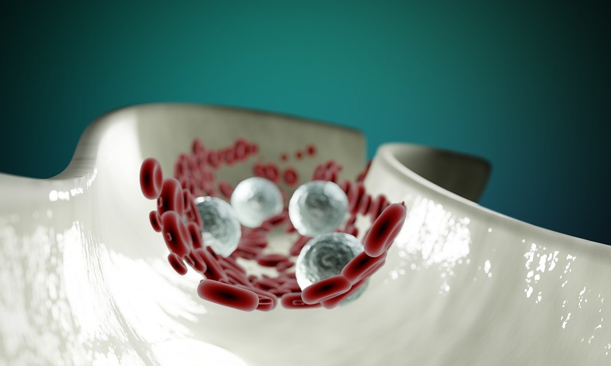 Эти 4 ощущения означают, что артерии закупорены холестерином