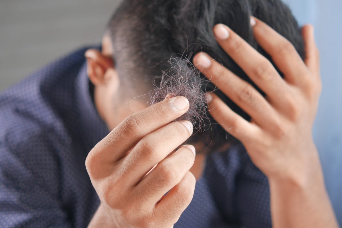Тяжелые и длительные заболевания щитовидной железы вызывают выпадение волос