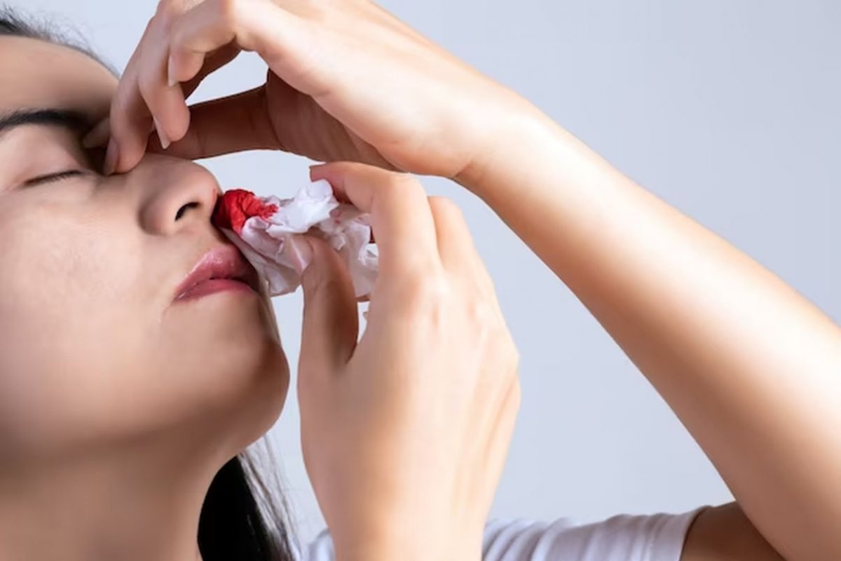 Врач: кровь из носа может указывать на гипертонию и гормональные проблемы
