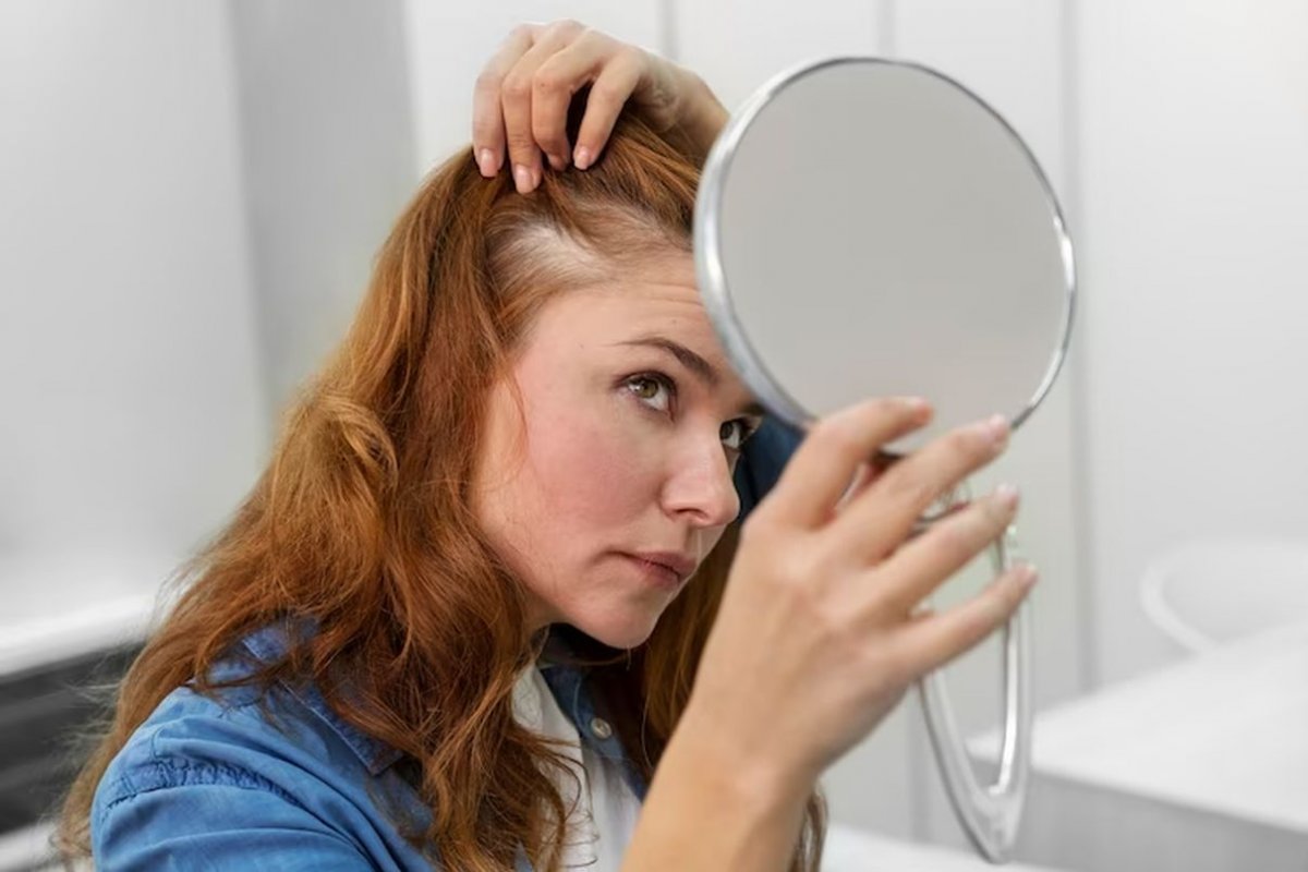 Врач Михалева: выпадение волос и сухость кожи могут указывать на гормональный дисбаланс