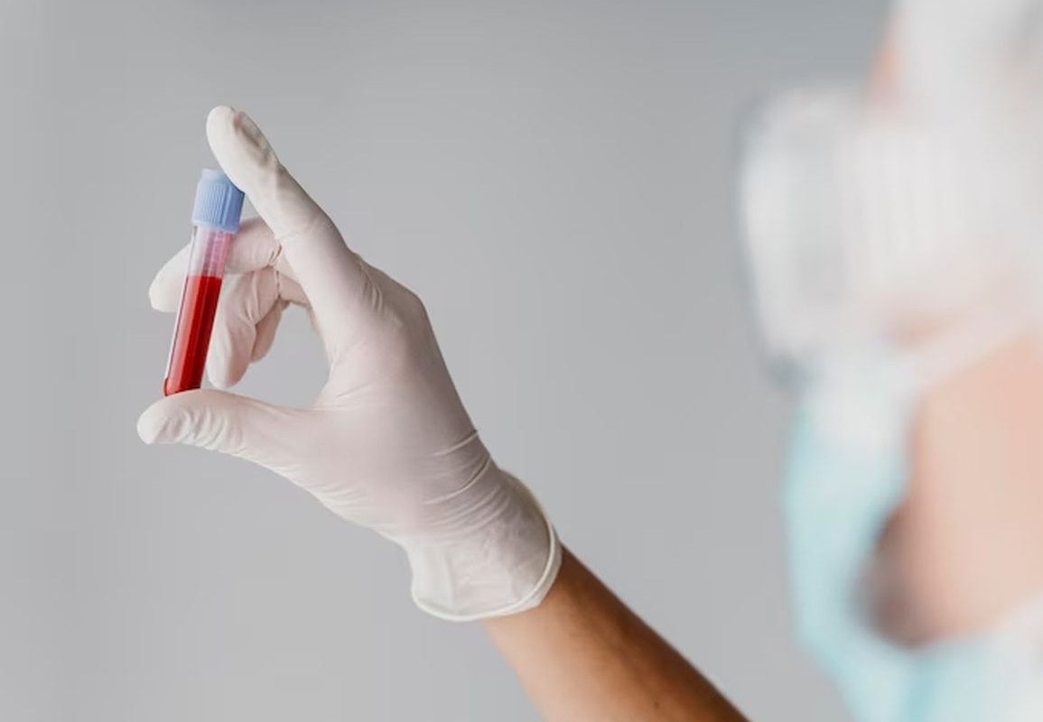 анализ крови