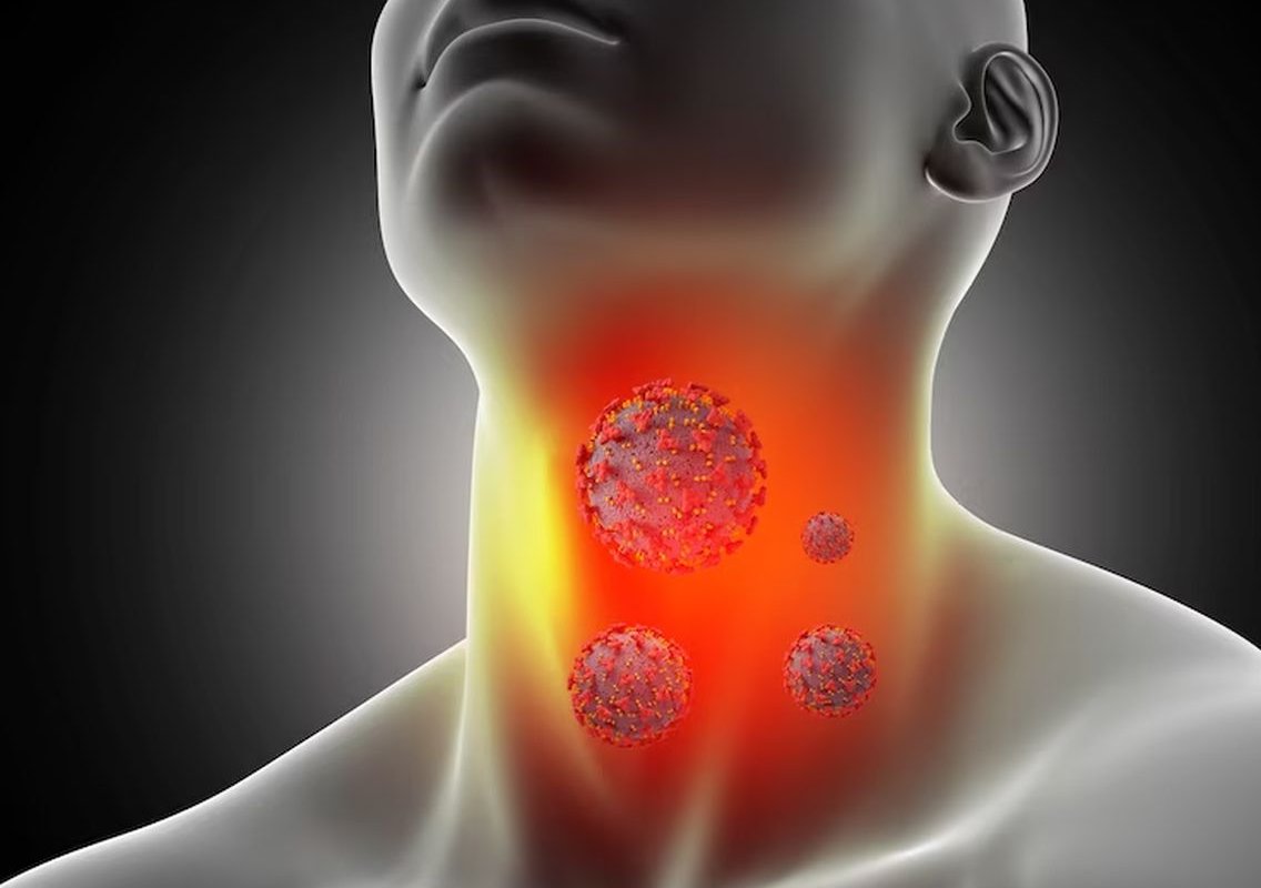 The Sun: онкологи назвали неочевидные симптомы рака щитовидной железы