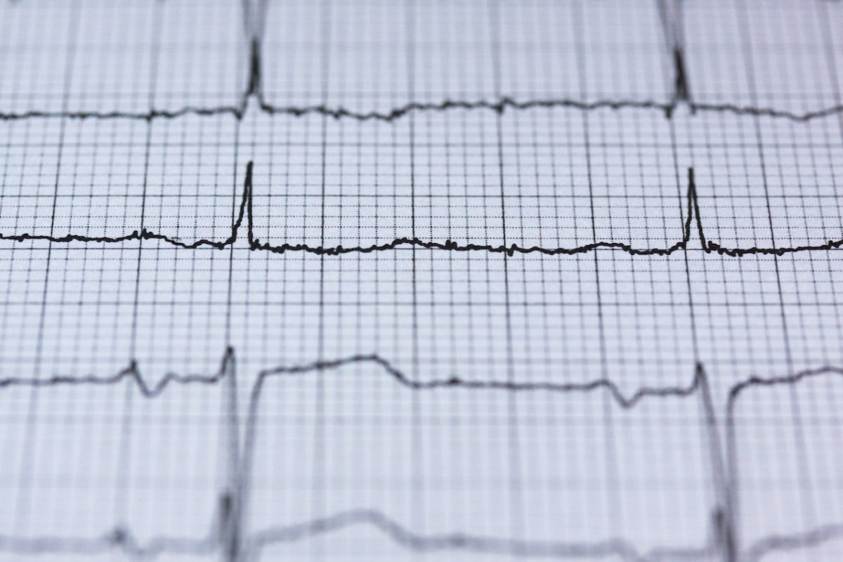 Кардиолог Варфоломеев назвал 5 признаков ранней сердечной недостаточности