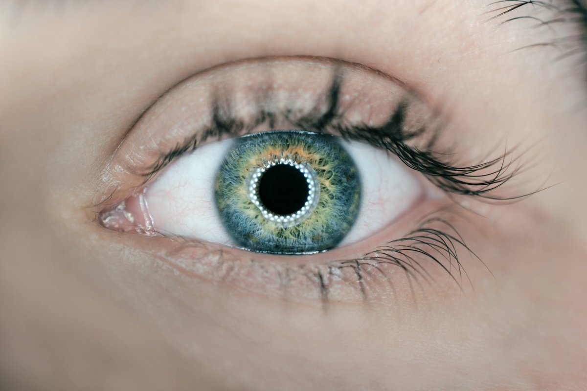 Врач Андреева: оттенок белков глаз сигнализирует о серьезном дефиците витамина В12