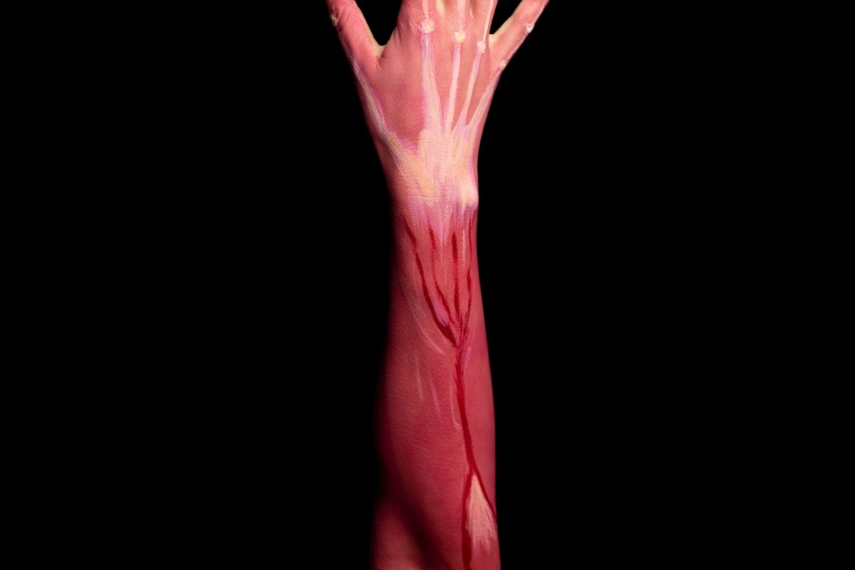 Кардиолог Варфоломеев: 4 признака в руке или ноге потенциально «опасного для жизни» тромба