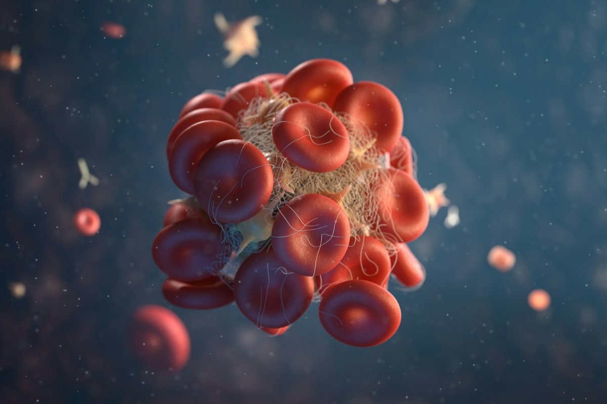 Хирург Викентьев рассказал о методах профилактики тромбообразования, кардиолог Варфоломеев назвал ключевые симптомы смертельного тромба