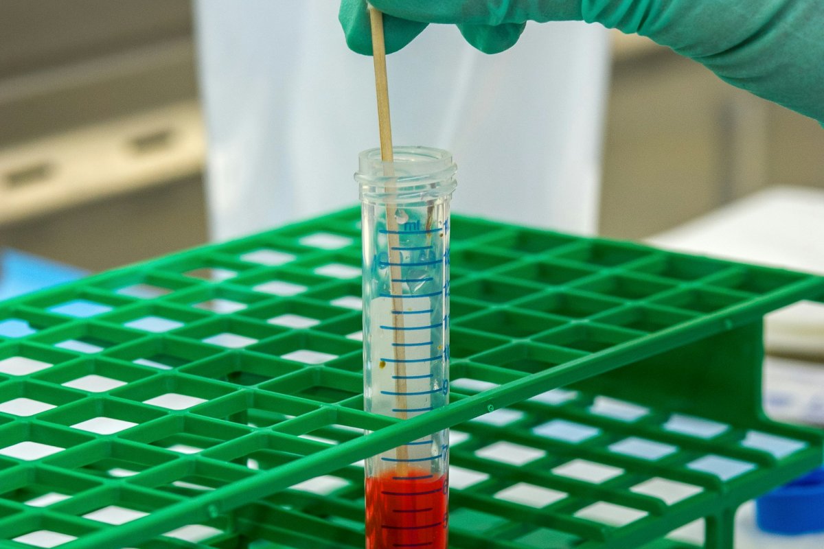 Врач Кореневич назвала продукты, от которых кровь становится густой как сироп, врач Захарова рассказала как не допустить образование сгустков крови