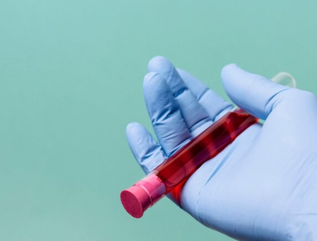 анализ крови