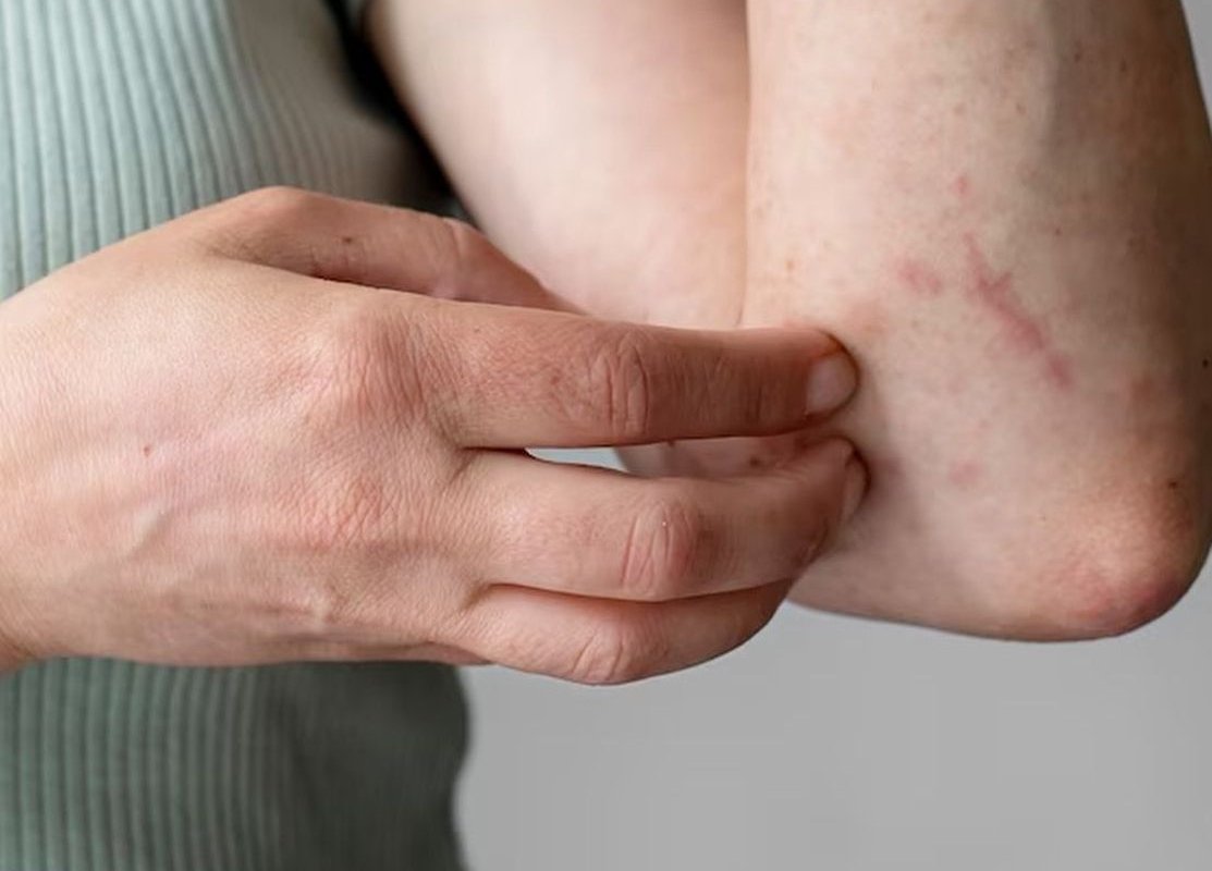 болезни кожи