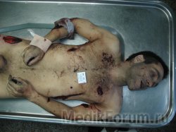 Чеченского киллера ликвидировали по приказу его руководства