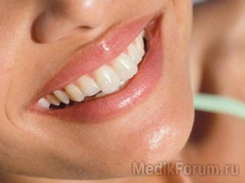 5 способов снять зубной камень самостоятельно