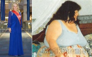 Толстячка сбросила 130 кг… от испуга